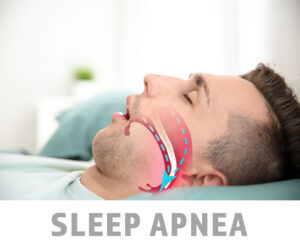 greenville sleep apnea